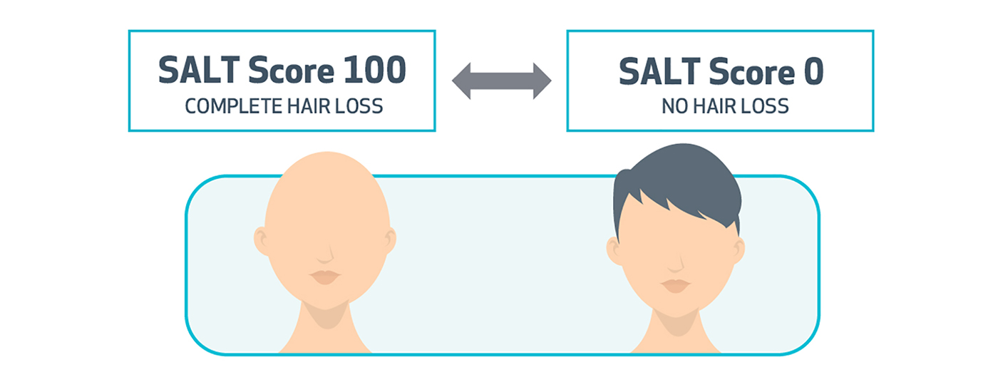 SALT measurement scale of scalp hair loss